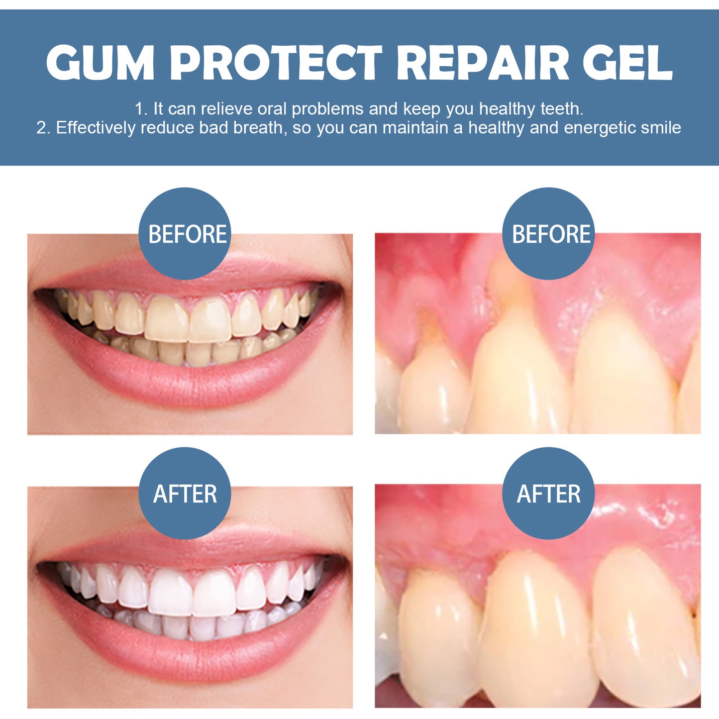 🥇Gum Repair Gel – Natural Relief for Sensitive Teeth, Bleeding Gums & Receding Gums