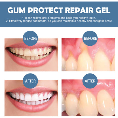 🥇Gum Repair Gel – Natural Relief for Sensitive Teeth, Bleeding Gums & Receding Gums